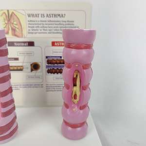 Modèle de comparaison de la trachée humaine saine et de la trachée asthmique |   <span class=keywords><strong>Aide</strong></span> pédagogique anatomique médicale pour l'éducation du système <span class=keywords><strong>respiratoire</strong></span> - Product Image 5