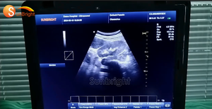 SUN-800F Appareil d'échographie 3D portable le plus vendu, instrument de diagnostic échographique PW CW pour usage humain - Product Image 6