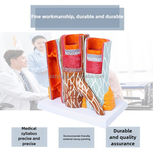 Model kapal darah anatomis tampilan PVC pendidikan 14x pembesaran struktur pembuluh darah - Product Image 3