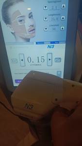 Vmax Maschinenkartuschen Schönheitssalon-Zubehör 20000 Schüsse 100000 Schüsse 10 Typen 1,5MM- 9,0MM für Alle Arten von Maschinen - Product Image 6