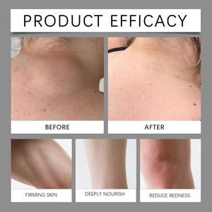 Produits de soin de la peau en marque privée, <span class=keywords><strong>crème</strong></span> pour le <span class=keywords><strong>visage</strong></span> au riz anti-âge, blanchissante, raffermissante, hydratante, <span class=keywords><strong>crème</strong></span> de soin de la peau à la nicotinamide - Product Image 6