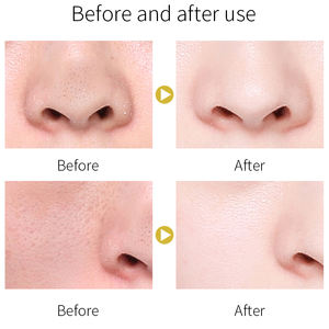 OEM ODM Limpieza profunda Barro Belleza Mascarilla Cuidado DE LA PIEL Orgánica Cúrcuma Arcilla Mascarilla para piel seca - Product Image 6