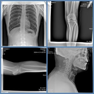 85kv portátil móvel veterinária <span class=keywords><strong>X</strong></span>-<span class=keywords><strong>Ray</strong></span> máquina para cães de estimação ortopédica equipamento médico móvel Competitive Vet <span class=keywords><strong>X</strong></span> <span class=keywords><strong>Ray</strong></span> máquina - Product Image 5