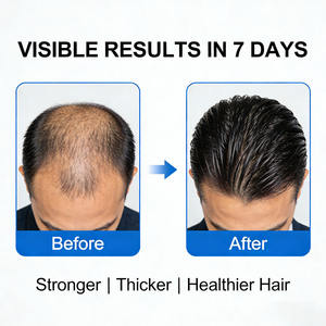 Sérum de croissance des cheveux à la rosemaine, traitement naturel du cuir chevelu anti-chute de cheveux, label privé biologique - Product Image 4