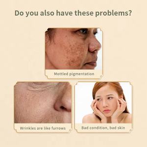 Poudre violette d'anthocyanine à base de plantes chinoises naturelles 300g, mélange antioxydant complet, extrait de beauté frais pour adultes, goût sucré, clair - Product Image 6