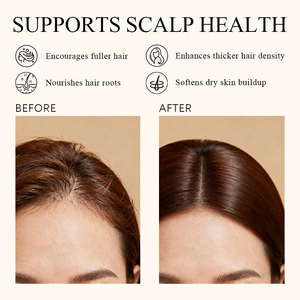 育毛オイルプライベートラベルオーガニックローズマリーヘアケアロストリートメント速く純粋な野生の髪の成長オイル - Product Image 4