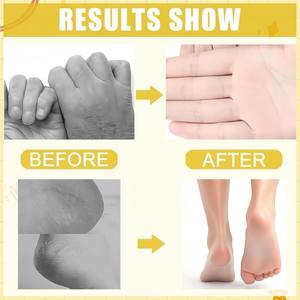 Harnstoff creme 60% 2% Salicylsäure für trockene Hände und Füße Cream Stick, erweicht, peelt und befeuchtet - Product Image 2