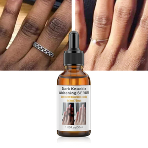 Siero OEM Sbiancante Rapido per Nocche Scure, Anti-Età, Correttore di Pigmentazione, Rimozione Intensa delle Macchie del Viso, Vitamina C - Product Image 1