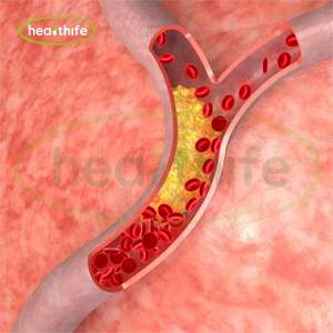 Healthife naturale OPC proantocianidine in polvere 95% estratto di corteccia di pino - Product Image 3