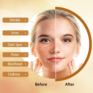 ターメリック手作り固形石鹸 レモンコウジ酸美白石鹸 シャワー＆フェイシャルディープクレンジング 顔と体のスキンケア用 - Product Image 5