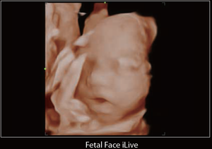 Ecógrafo <span class=keywords><strong>Mindray</strong></span> <span class=keywords><strong>DC</strong></span>-60Exp <span class=keywords><strong>DC</strong></span>-<span class=keywords><strong>70</strong></span>, Ecógrafo de Diagnóstico Médico <span class=keywords><strong>Mindray</strong></span>, Escáner de Ultrasonido Veterinario para Clínica Veterinaria y Hospital - Product Image 5