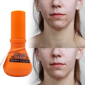 Produk Serum asam Azelaic, kosmetik Korea penghilang komedo kecantikan wajah perawatan kulit Anti jerawat