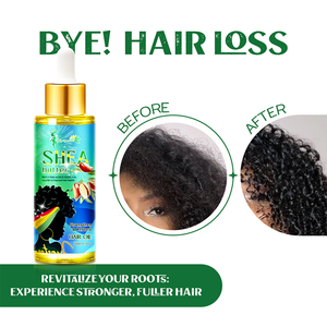 Ce n'est pas grave si vous noir ou blanc beurre de karité cheveux réparation huile sérum renforcer le cuir chevelu ensemble de soins capillaires - Product Image 3