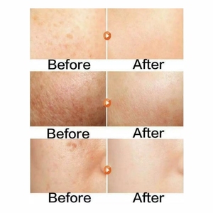 Sérum Liquide Visage OEM Arbutine Anti-Âge Éclaircissant Réparateur à l'Acide Hyaluronique pour Peaux Africaines 500ml Vitamine C - Product Image 3
