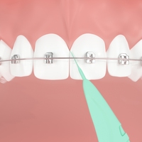 Choix de fil dentaire orthodontique de conception réutilisable recyclable de profil mince de haute qualité