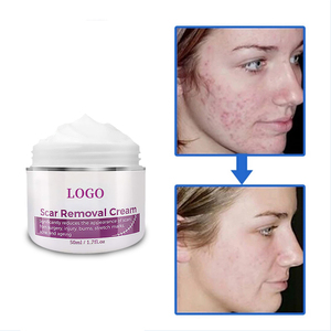 Crema China para eliminar cicatrices, crema hidratante y Reafirmante sin sulfato y crema de vitamina E y lavanda para eliminar cicatrices en la piel - Product Image 4