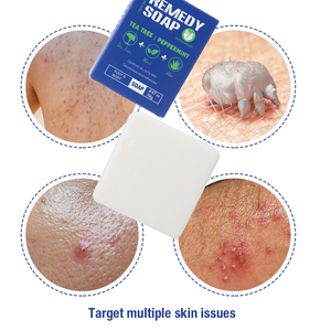 สบู่ก้อนทำมือจากธรรมชาติ 100%  ผสมทีทรีมิ้นท์ บรรเทาอาการคันแห้งบริเวณเท้า  ขจัดกลิ่นกาย  ได้รับการรับรองมาตรฐาน ISO GMP FDA สำหรับผลิตภัณฑ์แบรนด์ส่วนตัว - Product Image 4