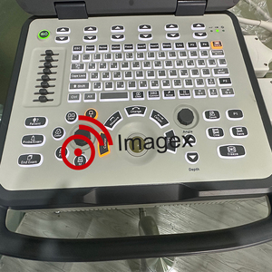 Y tế xách tay OB/gyn siêu âm DOPPLER màu siêu âm với thai nhi theo dõi nhịp tim - Product Image 4