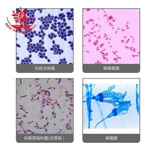 Diapositivas de laboratorio Flagellum Smear Gram Dyeing 50 Kinds Kit Hongos y células microbianas Diapositivas de biología Película Vidrio Bacterias Diapositivas preparadas - Product Image 5