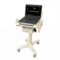 Nuevo Equipo Médico Avanzado, Máquina de Ultrasonido Doppler Portátil a Color para Uso Hospitalario