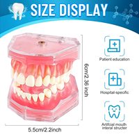 Modèle d'étude d'implant dentaire avec dents amovibles – Modèle standard pour l'enseignement médical (CE/ISO)
