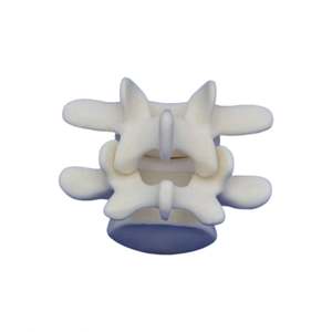 <span class=keywords><strong>Vertebra</strong></span> lombare <span class=keywords><strong>L4</strong></span> e L5 in schiuma solida KyrenMed modello osseo per la formazione in officina di ortopedia avvitamento e placcatura - Product Image 1