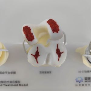 Kyrenmed รูปแบบการรักษาโรคข้อเข่าเสื่อม, แบบจำลองการรักษาโรคข้อเข่าเสื่อม5ขั้นตอน - Product Image 2