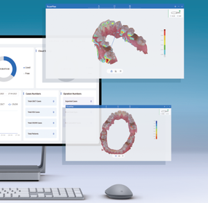 Scanner Intraorale Wireless 3D per Modelli Ortodontici e Riparazioni, Scansione Dentale 3D Senza Iniezione di Polvere - Product Image 6
