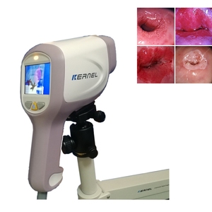 Kernel KN-2200I(H) Full HD 1080P alta definição digital Vídeo Colposcópio para ginecologia vulva exame cervical - Product Image 5