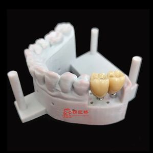 Prothèses dentaires d'<span class=keywords><strong>implant</strong></span> adaptées au système d'implantation traditionnel en <span class=keywords><strong>zircone</strong></span> ou couronne Pfm à des <span class=keywords><strong>prix</strong></span> abordables - Product Image 4