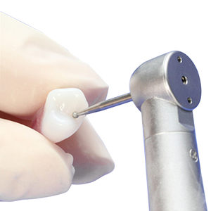 Simulatore Dentale per Pratica di Esame Odontoiatrico: Denti con Canale Radicolare e Cavità Pulpare Riempita in Resina - Product Image 5