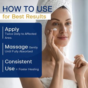Face Body Hydrating Moisturizer Fast-Acting Arnica Montana Arnica <strong>Bruise</strong> <strong>Cream</strong> <strong>for</strong> Bruising Swelling Discoloration &amp; Thin Skin - Product Image 6