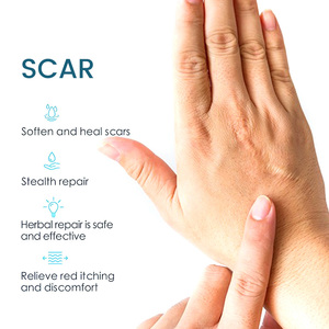 Crème Efficace et Puissante <span class=keywords><strong>pour</strong></span> Cicatrices d'Acné, <span class=keywords><strong>Boutons</strong></span>, Vergetures, Gel Visage, Crème Raffermissante <span class=keywords><strong>pour</strong></span> Vergetures et Effet Tummy Tuck - Product Image 6
