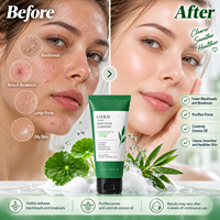 Nettoyant pour le visage en vrac 15% Centella Asiatica nettoyant pour le visage AHA BHA PHA crème hydratante de traitement de l'acné