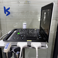 K-C102 Portable 15 pouces écran vétérinaire entièrement numérique ordinateur portable 3D 4D couleur Doppler Diagnostic Machine à ultrasons