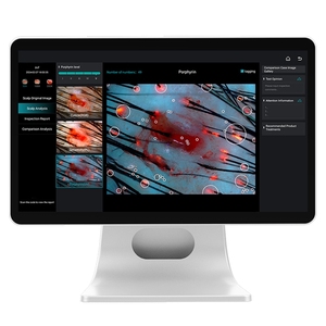 เครื่องวิเคราะห์ผิวหนังดิจิทัลอัจฉริยะ AI ปี 2025 พร้อมหน้าจอ HD ขนาด 15.6 นิ้ว สำหรับวิเคราะห์เส้นผมและผิวหนัง เทคโนโลยีใหม่ - Product Image 3