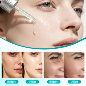 Suero Facial de Ácido Hialurónico PDRN de Marca Privada, Hidratación Profunda para Aliviar el Enrojecimiento, Mantenimiento de la Estabilidad, Reparación de la Piel Frágil, Suero OEM - Product Image 5