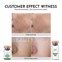 Diskon Besar Sampel Gratis Perawatan Jerawat Menghilangkan Bekas Jerawat dan Flek Hitam Serum Non-invasif Spons Mikroneedle untuk Peremajaan Kulit