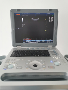 Mesin Ultrasonografi Doppler Medis Portabel <span class=keywords><strong>2</strong></span> Probe Portabel 3D 4D Doppler Warna - Product Image 4