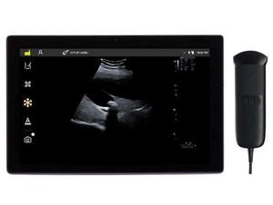 Vinno Q5-7L <strong>Portable</strong> Handheld Linear Array Ultrasound <strong>Scanner</strong> Diagnostic Device - Product Image 2