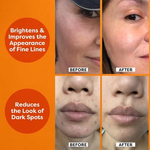 Siero schiarente con vitamina C acido ialuronico vitamina E anche il tono della pelle migliora l'aspetto delle macchie scure linee sottili E rughe - Product Image 5