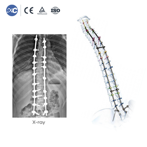 Set Completo de Instrumental Quirúrgico MIS de Alta Calidad para Cirugía de Columna y Endoscopia Espinal Médica - Product Image 4