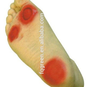Modelo avanzado de enseñanza y entrenamiento del pie diabético Especialidad en ciencias médicas-Modelo de anatomía humana - Product Image 1