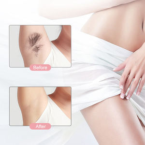 Épilateur électrique pour femmes plaqué or 18 carats, sans douleur, en forme de rouge à lèvres - Product Image 5