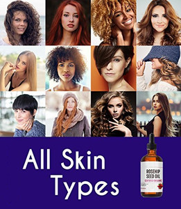 OEM <span class=keywords><strong>Huile</strong></span> <span class=keywords><strong>essentielle</strong></span> de cynorrhodon <span class=keywords><strong>Huile</strong></span> de rose musquée naturelle pure <span class=keywords><strong>Huile</strong></span> hydratante <span class=keywords><strong>anti</strong></span>-âge pour le <span class=keywords><strong>visage</strong></span> <span class=keywords><strong>Huile</strong></span> de cynorrhodon - Product Image 6