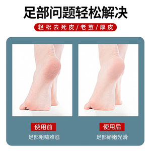 Stainless Steel Foot Scraper Callus Remover With Comfort Handle For Home Use - Product Image 5