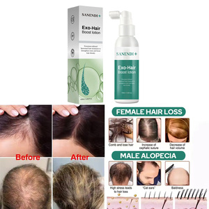 Sérum spray pour la croissance des cheveux OEM, pour régénérer les follicules pileux, favoriser une croissance et une nutrition saines des cheveux - Product Image 5