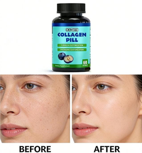 Capsules molles de 10 000 mg de vitamine C et de collagène, revitalisant pour la peau, capsules blanchissantes pour la peau à base de L-glutathion - Product Image 3