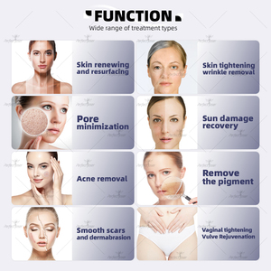 Da mỹ phẩm CO2 laser chuyên nghiệp loại bỏ vết sẹo máy âm đạo thắt chặt trẻ hóa da fractional Laser CO2 - Product Image 4