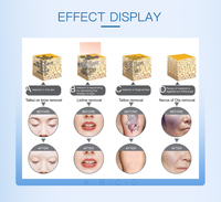 Ventes chaudes, machine portable de suppression de tatouage, d'élimination des points noirs, de peeling au carbone, de picoseconde-laser, 7 langues
